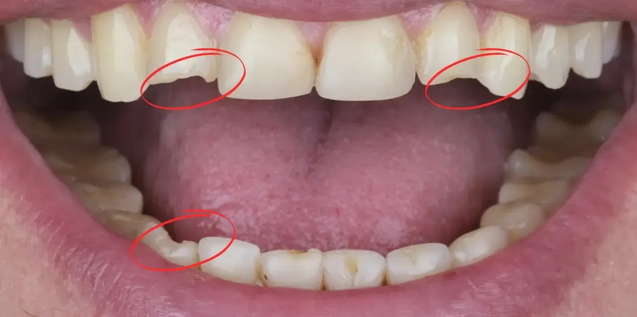 Cosmetic dental consultation with patient reviewing smile design options